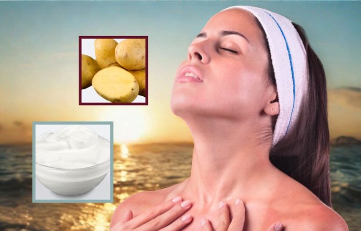 donna scottata dal sole e nel riquadro dello yogurt e delle patate